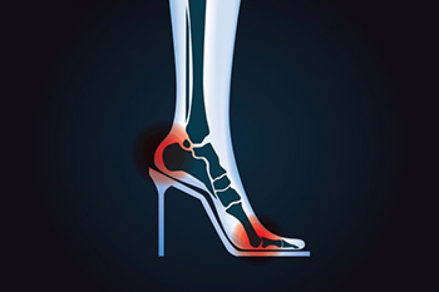 Is It Dangerous To Wear High Heels?