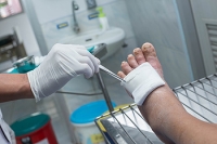 Problematic Diabetic Foot Symptoms