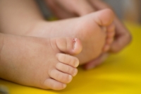 Ingrown Toenails in Children and Podiatric Care